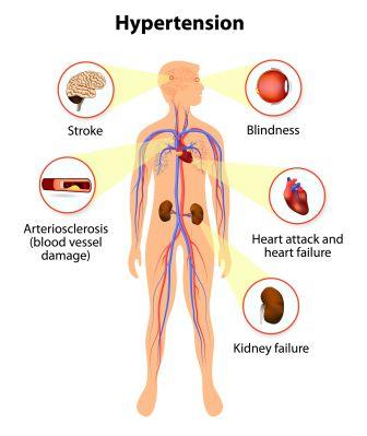complications of hypertension - high BP