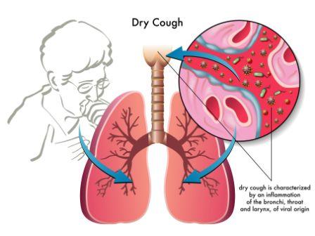 dry cough